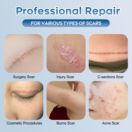 Advanced Silicone Scar Gel for Face & Body – Silicone Scar Cream for Old & New Scars, Reduces Appearance of Scars from Acne, Surgery, Burns, Injuries, C-Sections & More (3.53 Ounce)