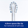 Bionix - Lighted CeraSpoon Ear Curette Tool, Earwax Removal Tool,