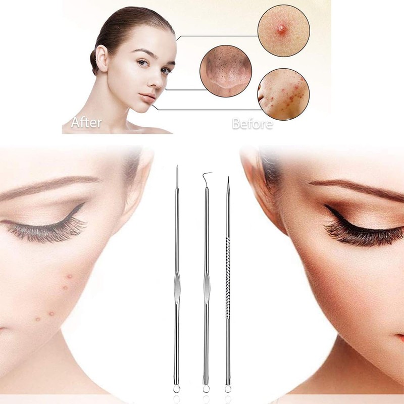 Plstod Blackhead Remover, Pimple Squeezing Tool, Blackhead Remover Set, for