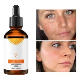 Serum Vitamina C Anti Envejecimiento Elimina Manchas 30ml                                                                                             