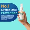 AIM Medical AIM Medical ScarMD Stretch Mark Oil, Minimizes the