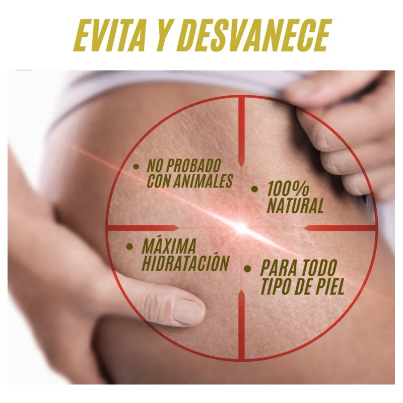 Kit Anti Estrías Y Celulitis + Un Protector De Rozaduras