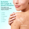 BUTBU 80 Pieces Large Pimple Patches, 18 x 31mm Translucent