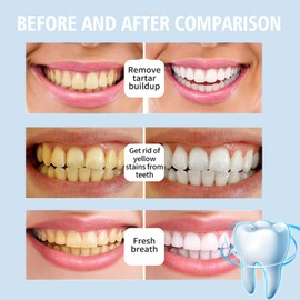 120g Hydroxyapatite Toothpaste,Hydroxyapatite Toothpaste for Enamel Protection,Fluoride-Free Formula with Gentle Mint,Protection for Sensitive Teeth,Long-Lasting Fresh Breath,Whitening Toothpaste