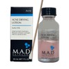 매드스킨케어 아크네 드라잉로션 [트러블 스팟] Mad Skin Care Acne Drying Lotion [Trouble Spot], 30ml × 1개