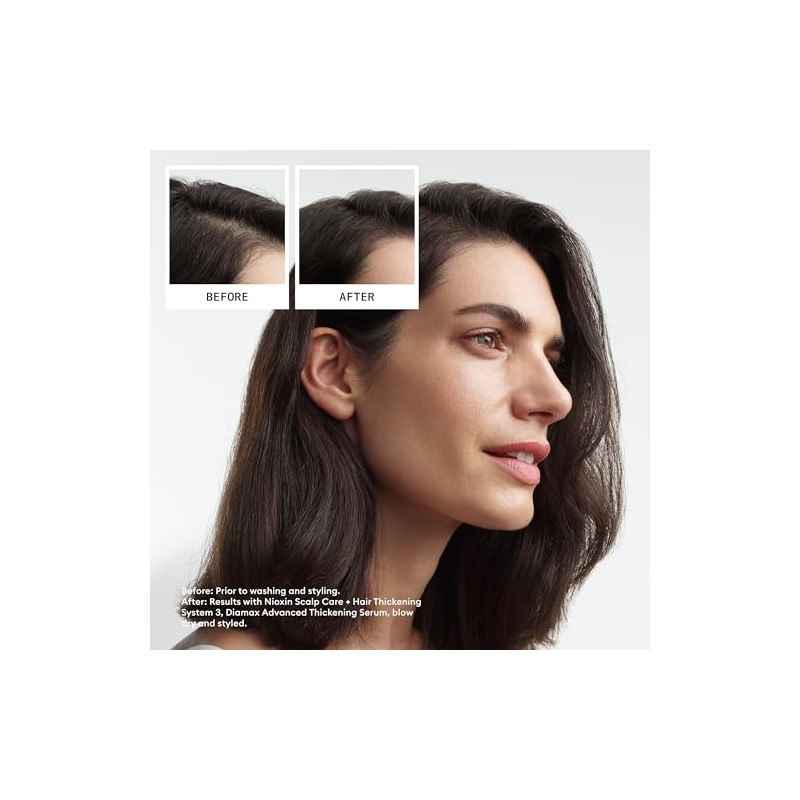 NIOXIN System 3 Scalp Activating Treatment, 3.4 Ounce