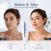 RF Conductive Gel for Beauty Devices – Hydrating Facial Gel