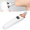 Electric Blackhead Removal Machine 3 Suction Gears Pores Vacuum Cleaner