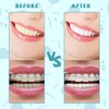 100PCS Interdental Brushes Between Teeth for Braces, Flossers Brush Cleaner
