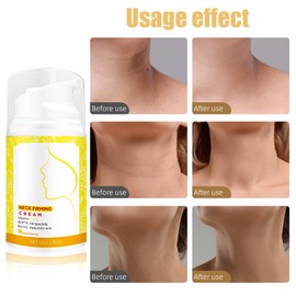 Neck Firming Cream with Collagen – Skin Tightening Cream Body & Face Anti-Aging Firming Neck Lotion for Women, Hydrating & Wrinkle Improvement