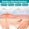 Yakiter 2M4CM Parches de Silicona para Cicatrices,Cinta para Cicatrices Recortable,Impermeable
