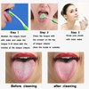 Tongue Brush, Tongue Scraper, Tongue Cleaner Helps Fight Bad Breath,
