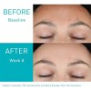2pcerave Gel Control Imperfecciones Con Ácido Salicílico 40m