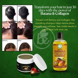 Batana Oil Hair Care Set-Shampoo with Collagen, Rosemary & Aloe Vera (16.9 fl oz) + Batana Oil Paste (4.16 oz) Nourishing & Moisturizing Duo–Salt-Free, Paraben-Free–For Dry & Thinning Hair–Men & Women