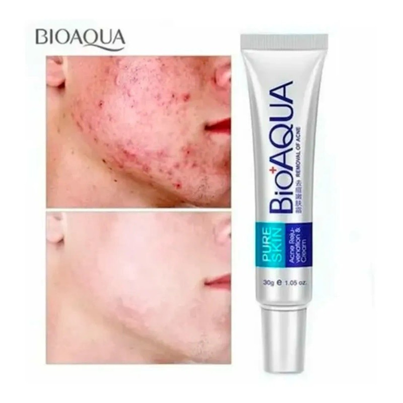 Bioaqua Acne Cream Reduce Cicatrices Poros Grasa Cuidado Continuo