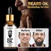 30 Ml Aceite Natural Para El Crecimiento La Barba Los
