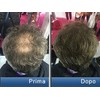 Pantogar (Pantovigar) Specific Treatment for Hair and Nails - 90