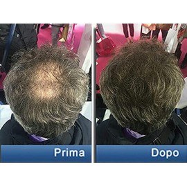 Pantogar (Pantovigar) Specific Treatment for Hair and Nails - 90 Cap