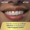 Waterpik WP-662 Water Flosser Electric Dental Countertop Professional NEW