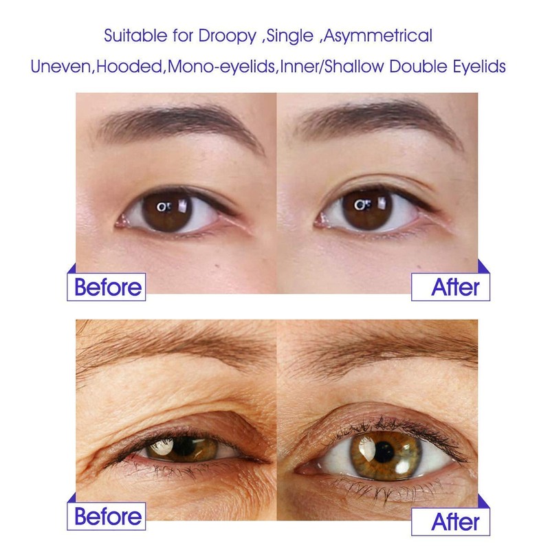 Eyelid Tapes Double Eyelid Sticker - Instant Eye Lid Lift