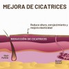 Scar Aid - Barra de silicona para tratamiento de cicatrices,