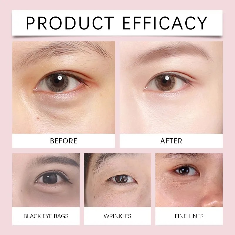 La Crema Reafirmante Para Ojos Levanta E Hidrata Los Ojos