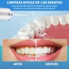 Irrigador Bucal Limpiador Dientes Eléctrico Con Boquillas Aleatorio