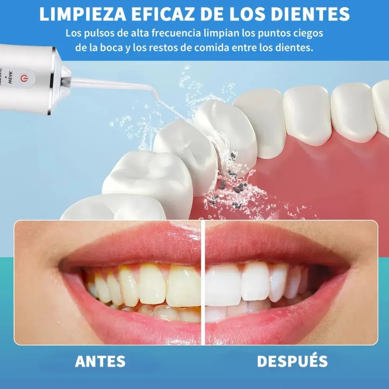 Irrigador Bucal Limpiador Dientes Eléctrico Con Boquillas Aleatorio