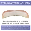 Professional Cosmetic Upper - New from Instant Smile! Hand Crafted