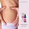 Pure Rose Hip Oil 100% Ecological 100ml Cold Pressed For