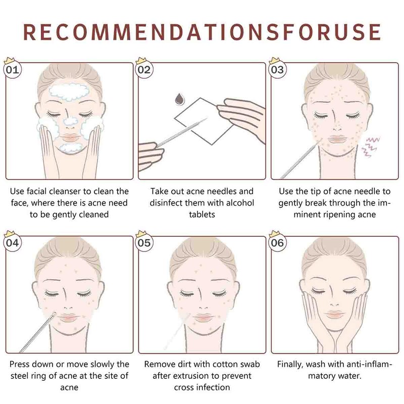 Pimple Popper Tool Kit, Whitehead Extractor Tool, Comedone Extractor, Blackhead