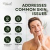 Erbaid Tea Tree Soap - Natural Acne-Fighting Cleanser