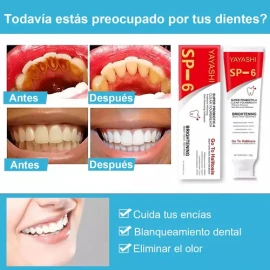 Paquete Dentales Blanqueadoras Probióticas Sp-6 De 2 Pastas