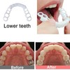 2 Pairs, Adjustable for Men and Women, Regain Confidence Smile,