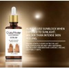 Get Rid of Dark Knuckles In 7 Days Serum Intense
