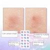 Cloud & Heart Pattern Pimple Patch, 108pcs/box Hydrocolloid Invisible Acne