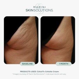 CelluliTX by Marini SkinSolutions for Unisex - 4 oz Cream