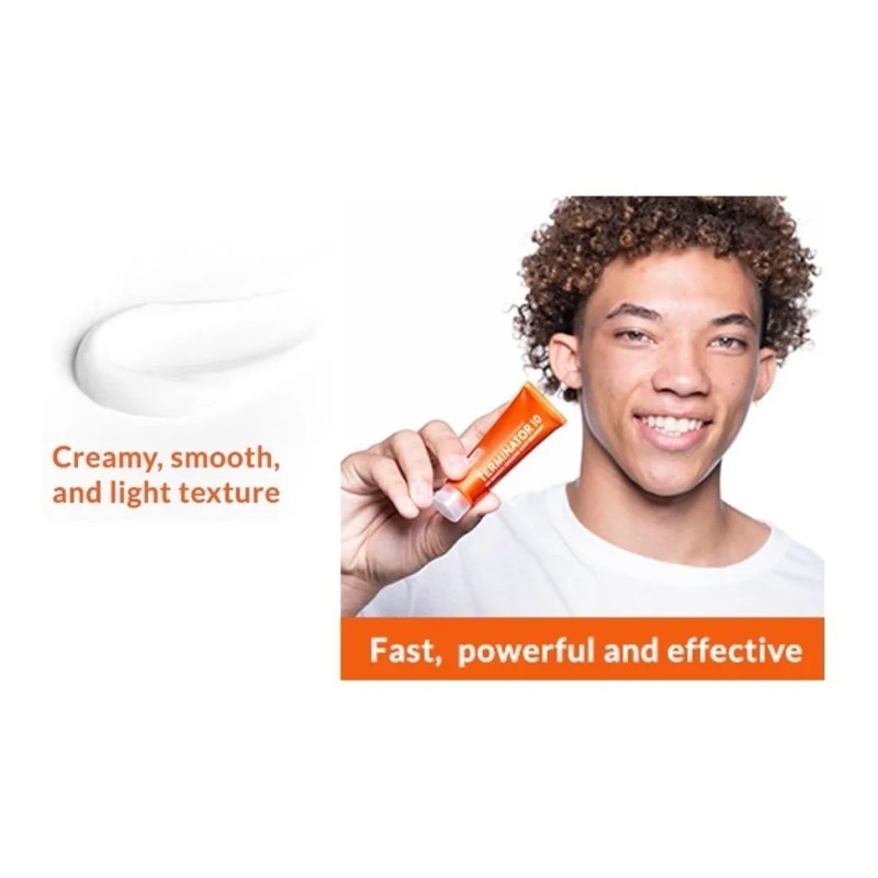 Acnefree Terminator 10 Acne Severo Con Peróxido De Benzoylo