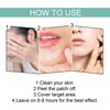 396Pcs Blemish Patches Facial Pimple Zit Spot Stickers Mild Non
