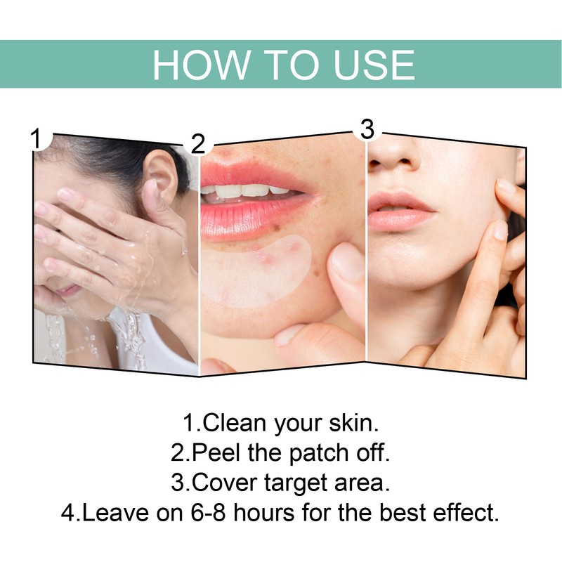 396Pcs Blemish Patches Facial Pimple Zit Spot Stickers Mild Non