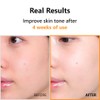 IsNtree Hyper Vitamin C 23 Serum | 23% Pure Vitamin