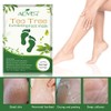 Foot Peel Mask 3 Pack Exfoliator Peel Off Calluses Dead