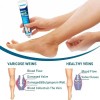 Crema Tratamiento Profesional Varices Venas Piernas Alivia