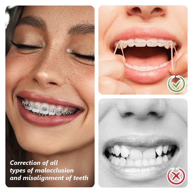WUSJCOF Set of 4 Teeth Rubber Bands, Orthodontic Elastic with