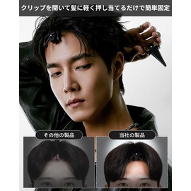 aninako Hair Volume Pincher, Set of 2, Bangs Hair Clip, Root Volumizer, Center Part, Eliminates Flat Hair, Natural Rise, For Hair Styling (Black x 2)
