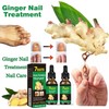 Ginger Nail, Tratamiento de Uñas con Jengibre, Soporte para Uñas,