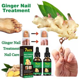 Ginger Nail, Tratamiento de Uñas con Jengibre, Soporte para Uñas, Cuidado de Uñas, Suero para El Crecimiento de Uñas con Jengibre, Aceite Fortalecedor para Uñas
