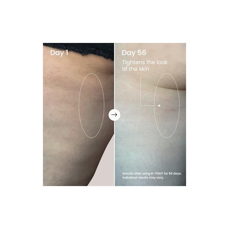 B-Tight Cellulite Reduction Lift & Firm Booty Cream by MAELYS