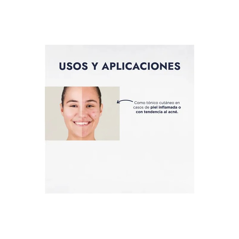Hidrolato de Geranio 1L Hebbe Cosmetics Tónico Facial para Piel