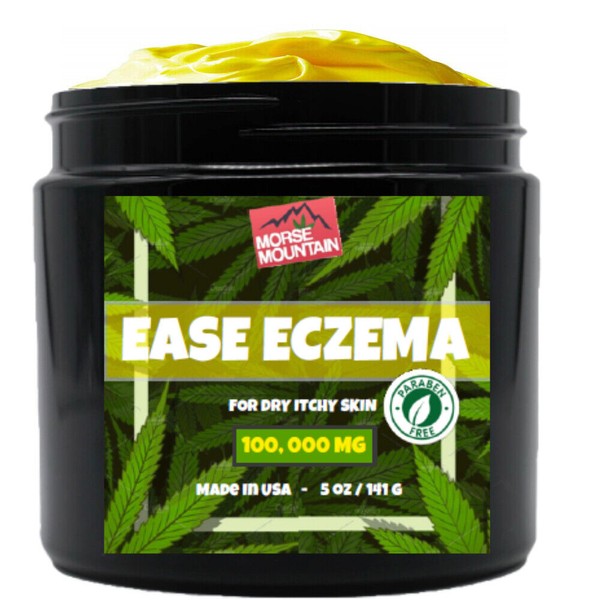 Psoriasis & Eczema Natural Treatment | for face and hands